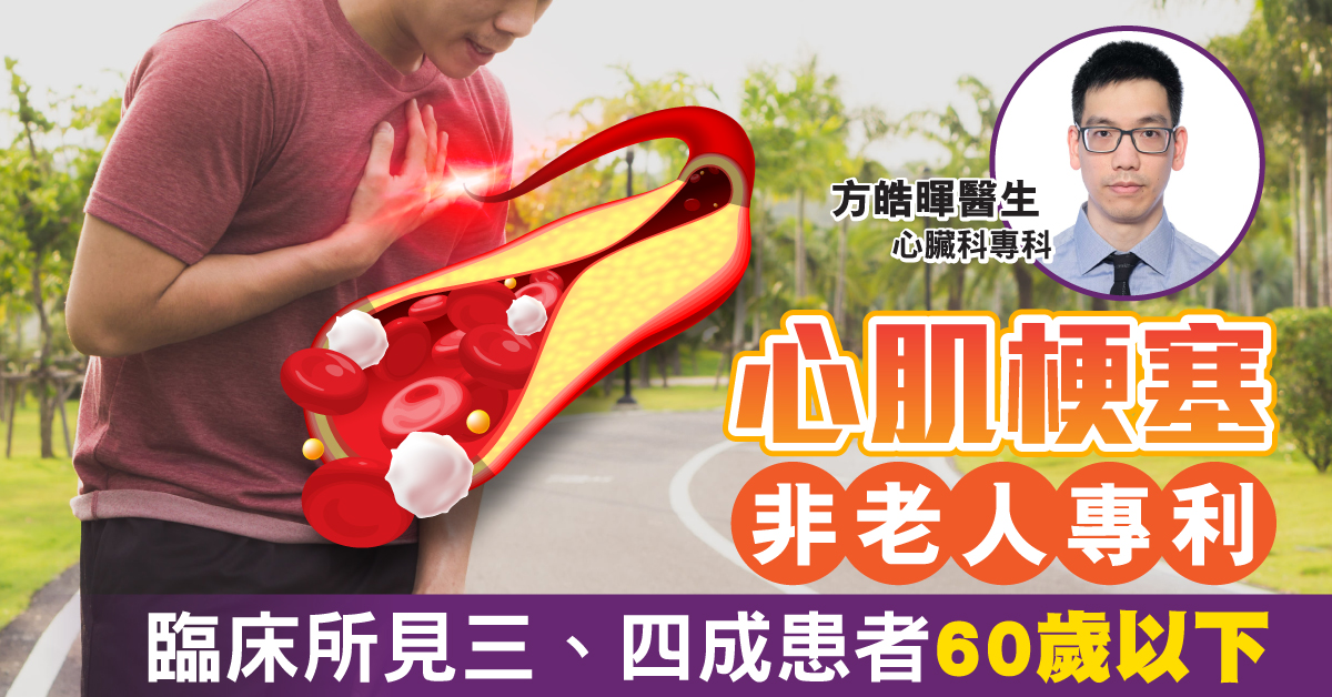 心肌梗塞非老人專利  臨床所見三、四成患者年60以下